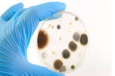 Microbiología (Semestral) 2019-20